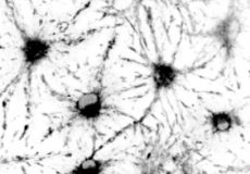 新工具让研究人员更好地了解大脑干细胞衰老