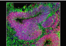 脑类器官揭示自闭症生物学和潜在治疗方法